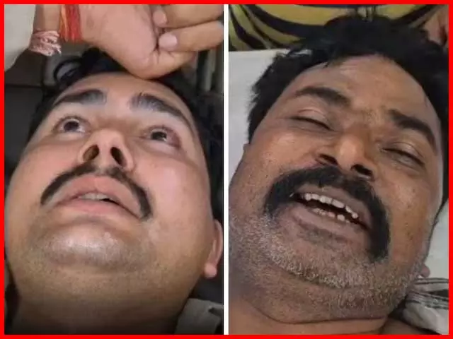 पुलिसकर्मियों पर जानलेवा हमला, आरोप- भू माफियाओं ने की जिंदा जलाने की कोशिश पुलिसकर्मियों पर जानलेवा हमला, आरोप- भू माफियाओं ने की जिंदा जलाने की कोशिश