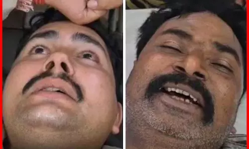पुलिसकर्मियों पर जानलेवा हमला, आरोप- भू माफियाओं ने की जिंदा जलाने की कोशिश