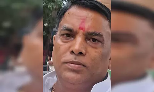 कार की सीट बेल्ट का इस्तेमाल, फैली सनसनी, जानें पूरा मामला कार की सीट बेल्ट का इस्तेमाल, फैली सनसनी, जानें पूरा मामला