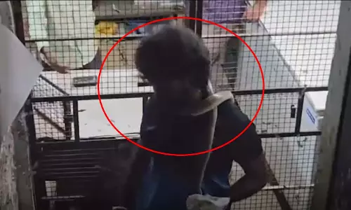 OMG! सांप गले में दिखा...डर गए लोग OMG! सांप गले में दिखा...डर गए लोग