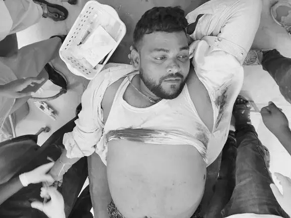 Gumla: धान व्यापारी को गोली मारकर लाखों की लूट, रांची रेफर Gumla: धान व्यापारी को गोली मारकर लाखों की लूट, रांची रेफर