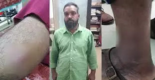 Kollam में गिरफ्तारी के दौरान मारपीट के आरोपी ने एसआई को काटा, कुत्ते को सीपीओ पर छोड़ा Kollam में गिरफ्तारी के दौरान मारपीट के आरोपी ने एसआई को काटा, कुत्ते को सीपीओ पर छोड़ा