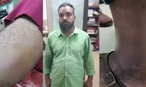 Kollam में गिरफ्तारी के दौरान मारपीट के आरोपी ने एसआई को काटा, कुत्ते को सीपीओ पर छोड़ा
