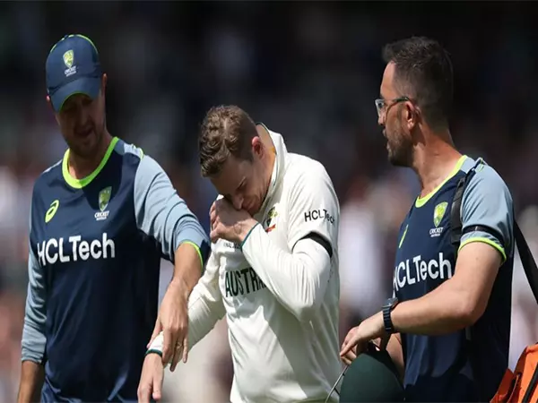 ऑस्ट्रेलियाई कप्तान पैट कमिंस ने Smith injury की चोट पर अपडेट दिया ऑस्ट्रेलियाई कप्तान पैट कमिंस ने Smith injury की चोट पर अपडेट दिया