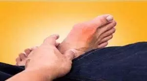 Health: युवाओं पर भारी पड़ रहा है गठिया रोग, बाबा रामदेव से जानें क्या हैं बचाव के उपाय Health: युवाओं पर भारी पड़ रहा है गठिया रोग, बाबा रामदेव से जानें क्या हैं बचाव के उपाय