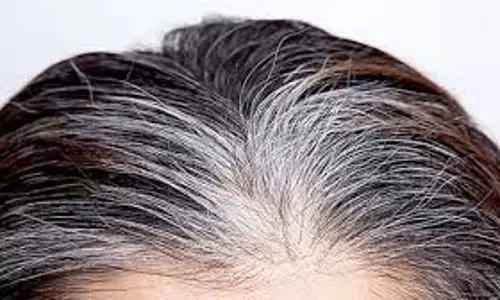 Hair Care: कम उम्र में बढ़ रही बाल सफेद होने की समस्या, जानें इसके पीछे के कारण और बचाव के आसान उपाय Hair Care: कम उम्र में बढ़ रही बाल सफेद होने की समस्या, जानें इसके पीछे के कारण और बचाव के आसान उपाय