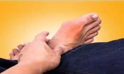 Health: युवाओं पर भारी पड़ रहा है गठिया रोग, बाबा रामदेव से जानें क्या हैं बचाव के उपाय
