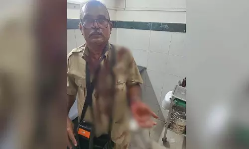 कुर्ला में ड्यूटी के दौरान कंडक्टर पर बेरहमी से हमला करने के बाद बेस्ट वर्कर्स यूनियन ने कार्रवाई की मांग की