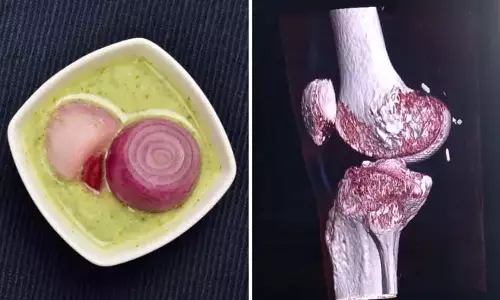 प्याज है फायदेमंद, लेकिन गलत तरीके से खाए तो बन सकती है बड़ी बीमारी