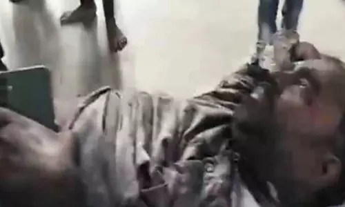 गरम डस्ट में गिरे मजदूर, स्पंज आयरन प्लांट में हादसा
