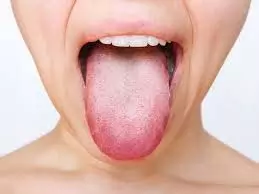 जीभ आपके स्वास्थ्य के बारे में बहुत कुछ कहती है जीभ आपके स्वास्थ्य के बारे में बहुत कुछ कहती है