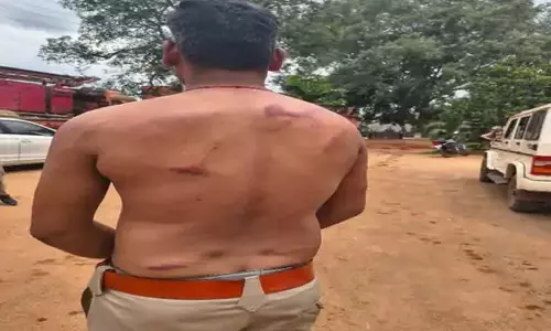 ग्रामीणों ने वन विभाग की टीम पर किया हमला, डिप्टी रेंजर सहित चार कर्मी घायल