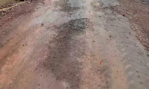 Kasauli: पतली सड़कें, ज्यादा समस्याएं! Kasauli: पतली सड़कें, ज्यादा समस्याएं!