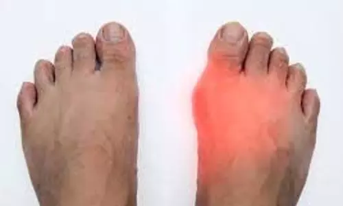 Health: यूरिक एसिड होगा जड़ से खत्म, इन घरेलू उपायों की लें मदद Health: यूरिक एसिड होगा जड़ से खत्म, इन घरेलू उपायों की लें मदद