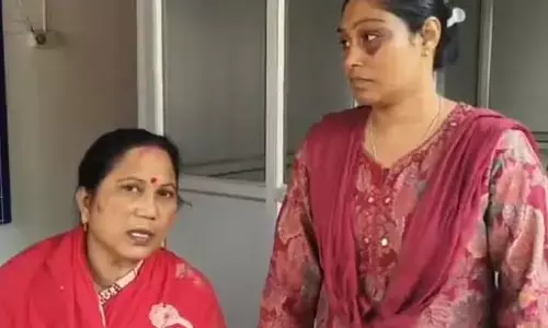 महिला पार्षद के खिलाफ राजनीतिक षड्यंत्र, हाथापाई से आंख में आई सूजन