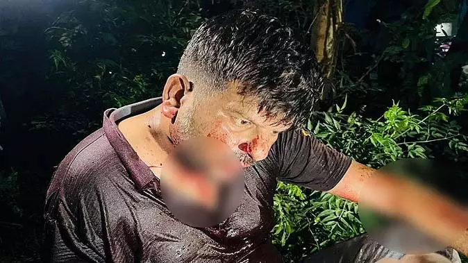 चलती गाड़ी में किसान की गर्दन काटी, पलटने से बची कार, अस्पताल में भर्ती चलती गाड़ी में किसान की गर्दन काटी, पलटने से बची कार, अस्पताल में भर्ती