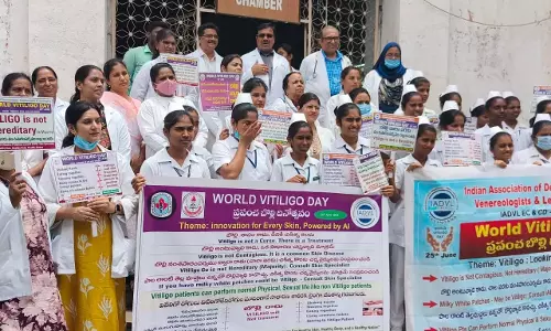 विश्व विटिलिगो दिवस के अवसर पर OGH में जागरूकता रैली निकाली