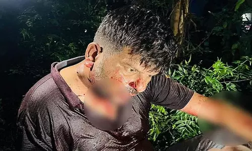 चलती गाड़ी में किसान की गर्दन काटी, पलटने से बची कार, अस्पताल में भर्ती चलती गाड़ी में किसान की गर्दन काटी, पलटने से बची कार, अस्पताल में भर्ती
