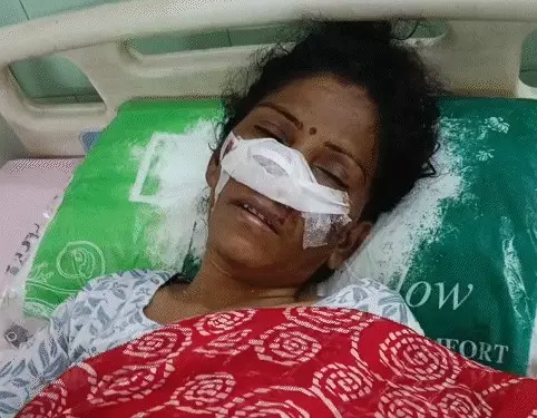 Bareilly: पत्नी के चरित्र पर संदेह में पति ने काटी नाक Bareilly: पत्नी के चरित्र पर संदेह में पति ने काटी नाक