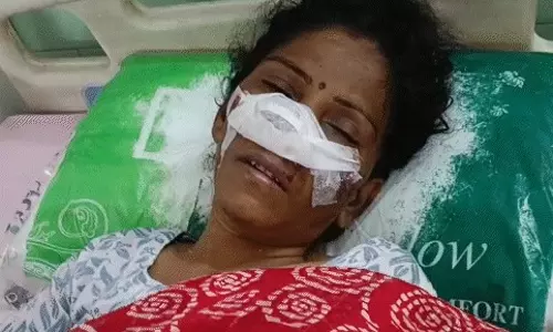 Bareilly: पत्नी के चरित्र पर संदेह में पति ने काटी नाक Bareilly: पत्नी के चरित्र पर संदेह में पति ने काटी नाक