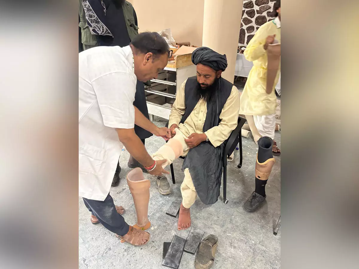 जयपुर फुट शिविर को अफगानिस्तान में उत्साहजनक प्रतिक्रिया मिली जयपुर फुट शिविर को अफगानिस्तान में उत्साहजनक प्रतिक्रिया मिली