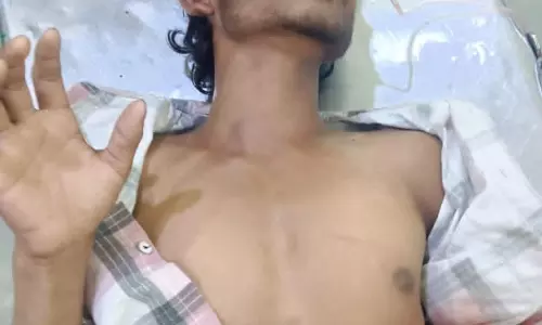 रायपुर : लेडी डॉन के भाई ने मारा चाकू