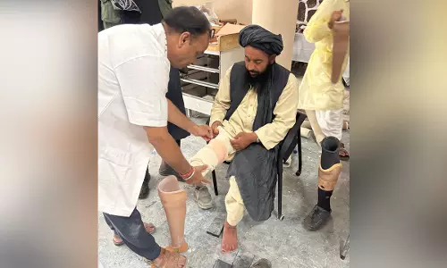 जयपुर फुट शिविर को अफगानिस्तान में उत्साहजनक प्रतिक्रिया मिली जयपुर फुट शिविर को अफगानिस्तान में उत्साहजनक प्रतिक्रिया मिली