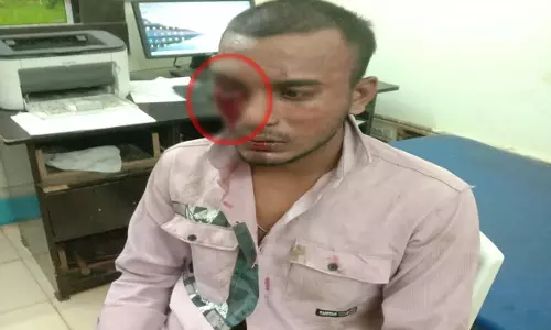 Raipur Breaking: बहन से बात क्यों करते हो कहकर युवक की बेरहमी से पिटाई, देखें VIDEO...