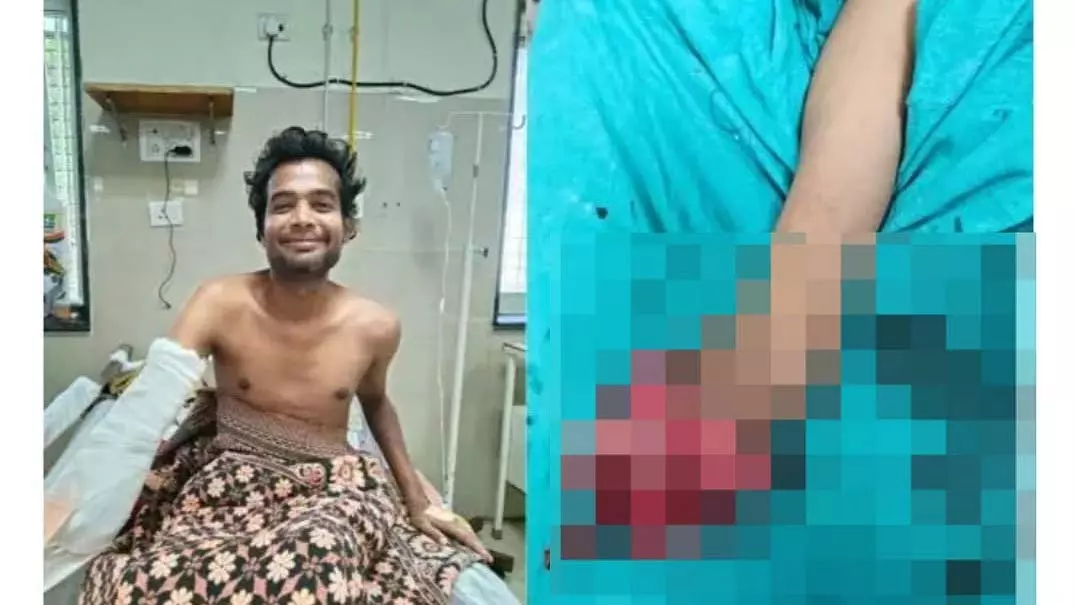 गेम के आदी युवक रेल की पटरी पर PUBG खेलते हुए ट्रेन की चपेट में आया; दाहिना हाथ खो दिया गेम के आदी युवक रेल की पटरी पर PUBG खेलते हुए ट्रेन की चपेट में आया; दाहिना हाथ खो दिया