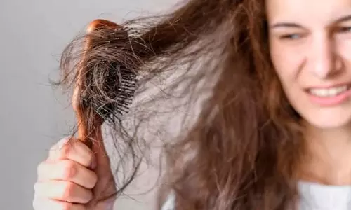Hair Care: मानसून में चिपचिपे हो गए हैं आपके बाल तो ऐसे बनाएं मुलायम, सिर्फ 10 रुपये की ये चीज आएगी काम Hair Care: मानसून में चिपचिपे हो गए हैं आपके बाल तो ऐसे बनाएं मुलायम, सिर्फ 10 रुपये की ये चीज आएगी काम