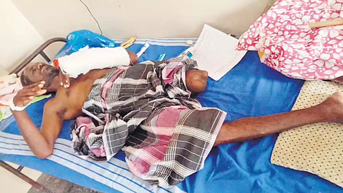 तमिलनाडु के मुदुकुलथुर में दिव्यांग व्यक्ति पर हमला करने के आरोप में कांस्टेबल को निलंबित किया गया तमिलनाडु के मुदुकुलथुर में दिव्यांग व्यक्ति पर हमला करने के आरोप में कांस्टेबल को निलंबित किया गया