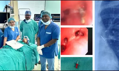 फेफड़े में फंसी थी पिन, किशोर की जान रायपुर एम्स के डॉक्टरों ने बचाई