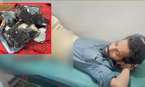 Hyderabad : पैंट की जेब में मोबाइल फटा, युवक गंभीर रूप से घायल Hyderabad : पैंट की जेब में मोबाइल फटा, युवक गंभीर रूप से घायल