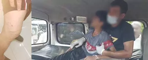 केरल में कुत्ते के काटने से हुई मौतों के बाद रेबीज रोकथाम पर तमिलनाडु ने एडवाइजरी जारी की केरल में कुत्ते के काटने से हुई मौतों के बाद रेबीज रोकथाम पर तमिलनाडु ने एडवाइजरी जारी की