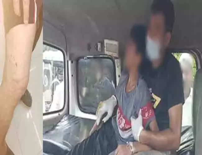 कुत्ते के काटने से हुई मौतों के बाद Tamil ने रेबीज की रोकथाम पर परामर्श जारी किया कुत्ते के काटने से हुई मौतों के बाद Tamil ने रेबीज की रोकथाम पर परामर्श जारी किया