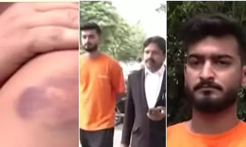 Bengaluru : सी बर्ड बस स्टाफ ने मॉडल पर किया हमला Bengaluru : सी बर्ड बस स्टाफ ने मॉडल पर किया हमला