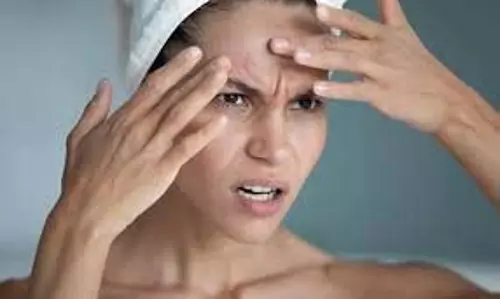 Skin care: गर्मी के कारण अगर आपकी त्वचा का रंग काला पड़ गया है तो लगाएं ये फेस पैक, चेहरे पर आएगी चमक Skin care: गर्मी के कारण अगर आपकी त्वचा का रंग काला पड़ गया है तो लगाएं ये फेस पैक, चेहरे पर आएगी चमक