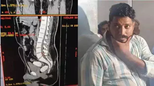 KOLLAM: कंडोम में एमडीएमए की तस्करी की कोशिश के आरोप में युवक गिरफ्तार