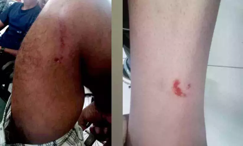 Kerala : कुत्ते के काटने से बच्चों समेत सात लोग घायल Kerala : कुत्ते के काटने से बच्चों समेत सात लोग घायल