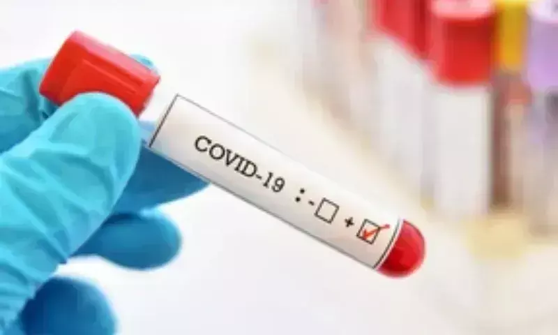 Manipur में COVID-19 के मामलों में कमी, सक्रिय मामलों की संख्या घटकर 38 हुई
