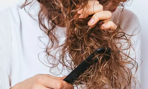 Hair Care: मौसम बदलते ही बढ़ रहा है बालों का झड़ना, तो इन आसान टिप्स से करें इनका बचाव Hair Care: मौसम बदलते ही बढ़ रहा है बालों का झड़ना, तो इन आसान टिप्स से करें इनका बचाव
