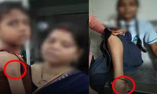 लाउडस्पीकर मुनादी कर खूंखार कुत्ते से सावधान रहने की अपील, काटने से 13 लोग घायल