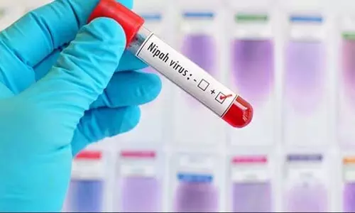 निपाह वायरस की दस्तक के बाद पड़ोसी राज्य सतर्क निपाह वायरस की दस्तक के बाद पड़ोसी राज्य सतर्क