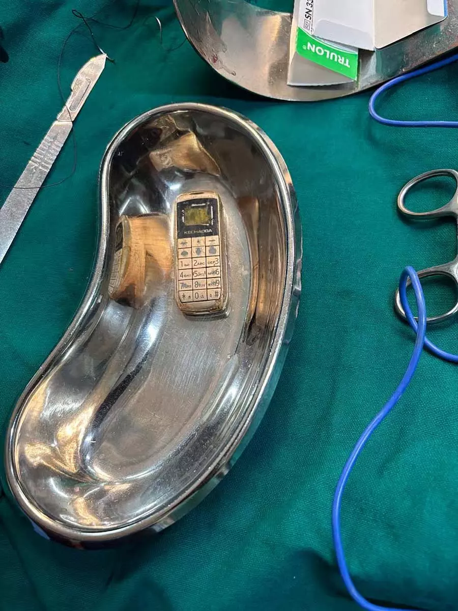 शिवमोग्गा सेंट्रल जेल: कैदी के पेट में मोबाइल फोन मिला शिवमोग्गा सेंट्रल जेल: कैदी के पेट में मोबाइल फोन मिला