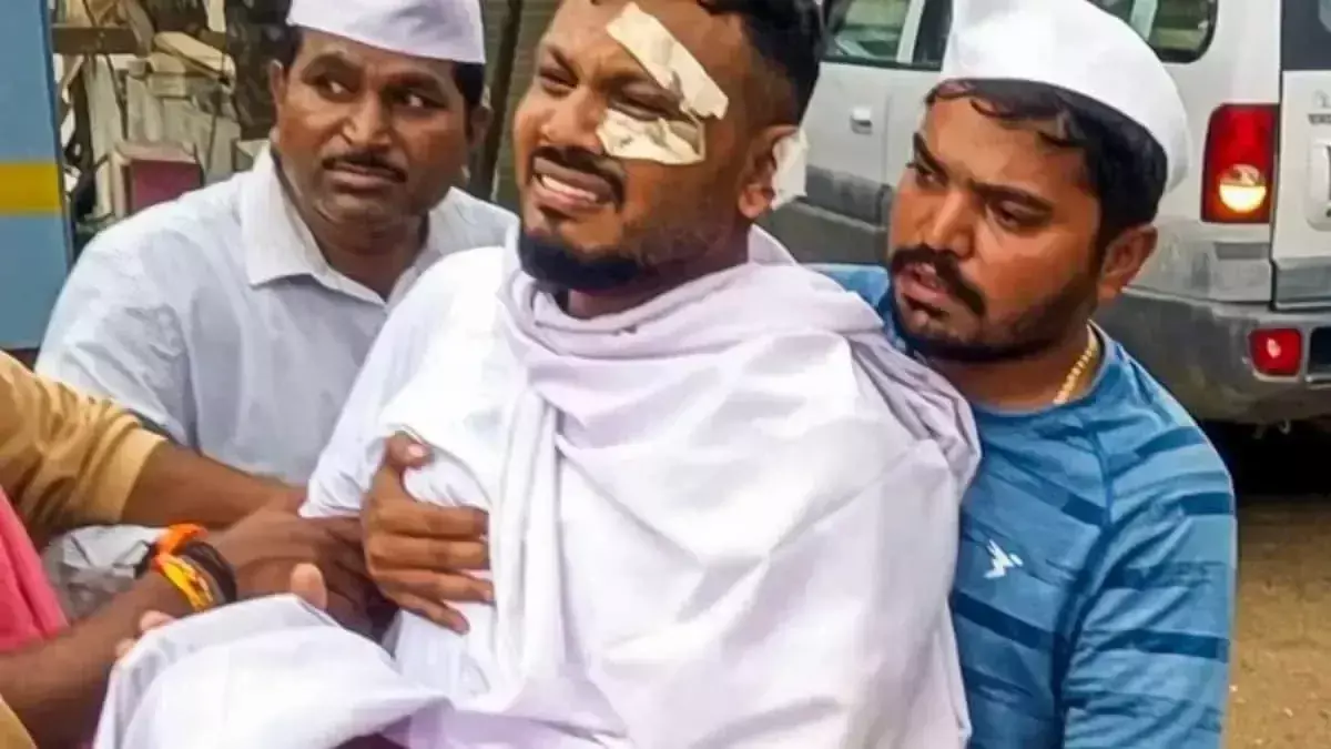 Gujarat: प्लेन क्रैश सर्वाइवर विश्वास की मनःस्थिति बिगड़ी, भावनात्मक तनाव में