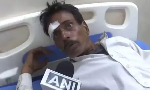 कुलगाम में तीन बसों की टक्कर में 10 अमरनाथ तीर्थयात्री घायल