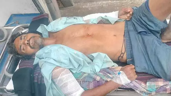 CG: हाथी ने युवक पर किया हमला, ग्रामीण की हालत नाजुक CG: हाथी ने युवक पर किया हमला, ग्रामीण की हालत नाजुक