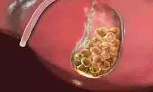 Health: पित्ताशय की पथरी, क्या सर्जरी जरूरी है या आयुर्वेदिक उपचार भी कारगर हो सकता है Health: पित्ताशय की पथरी, क्या सर्जरी जरूरी है या आयुर्वेदिक उपचार भी कारगर हो सकता है