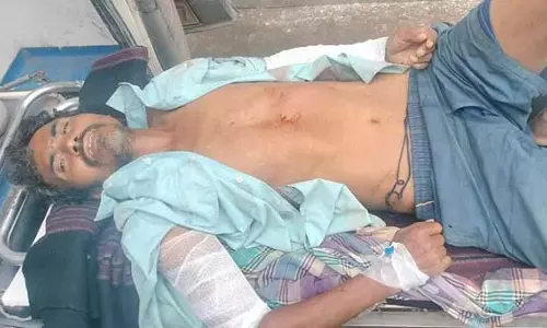 CG: हाथी ने युवक पर किया हमला, ग्रामीण की हालत नाजुक