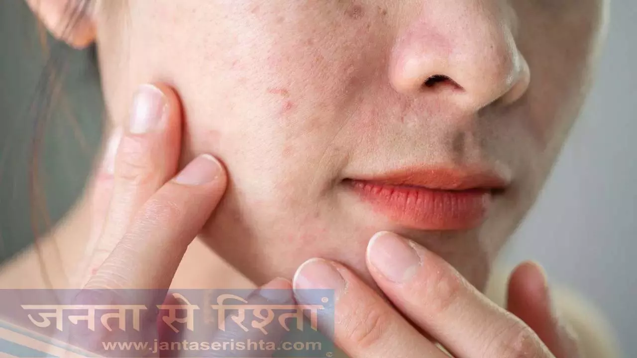 बरसात के मौसम में अपनी त्वचा को खतरनाक बैक्टीरिया से कैसे बचाएं? बरसात के मौसम में अपनी त्वचा को खतरनाक बैक्टीरिया से कैसे बचाएं?